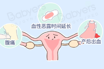 女人产后子宫恢复好不好，看这 2 点就知道！