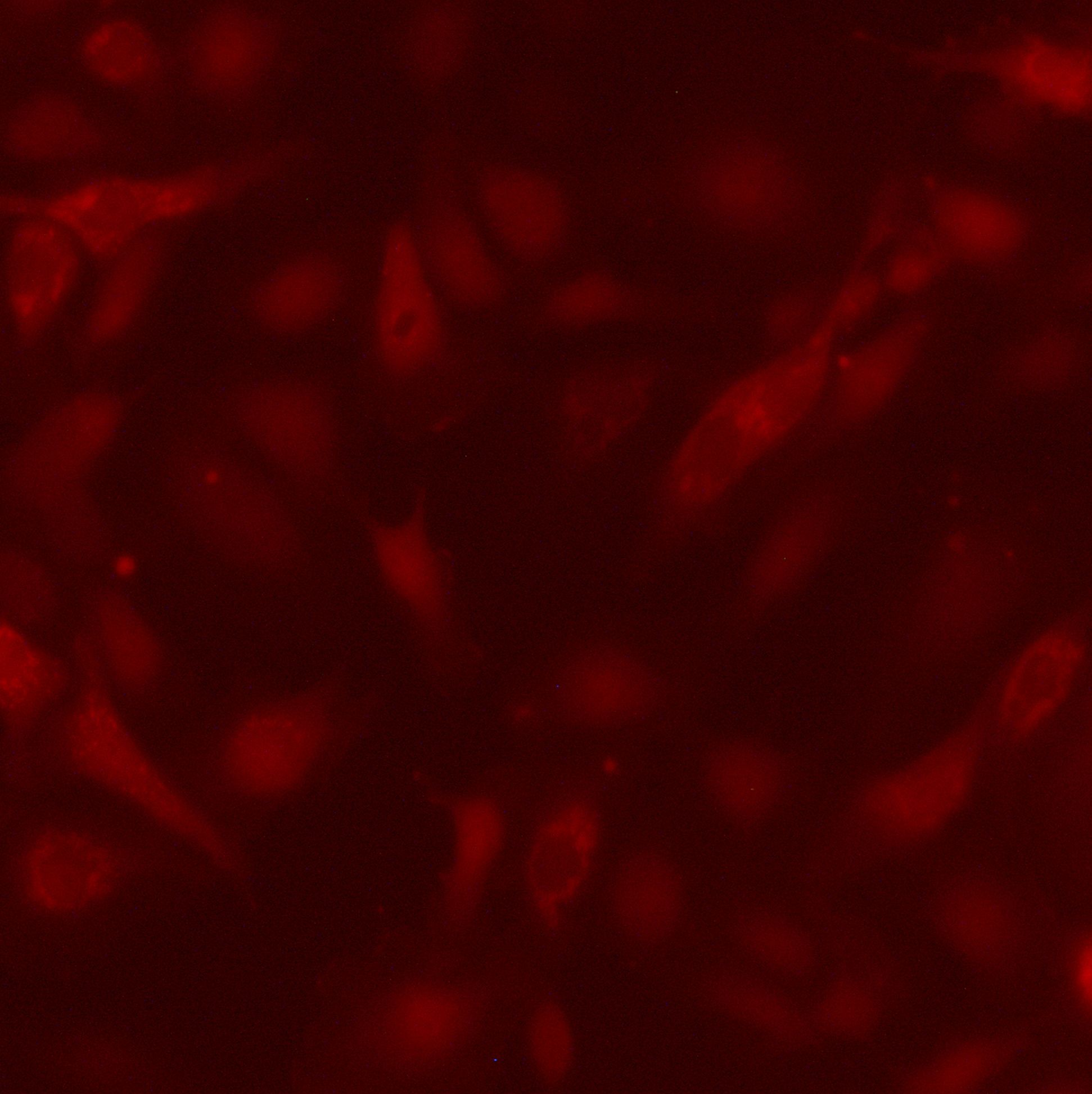 HUVEC-RFP[HUVEC/RFP]红色荧光蛋白标记的人脐静脉内皮细胞