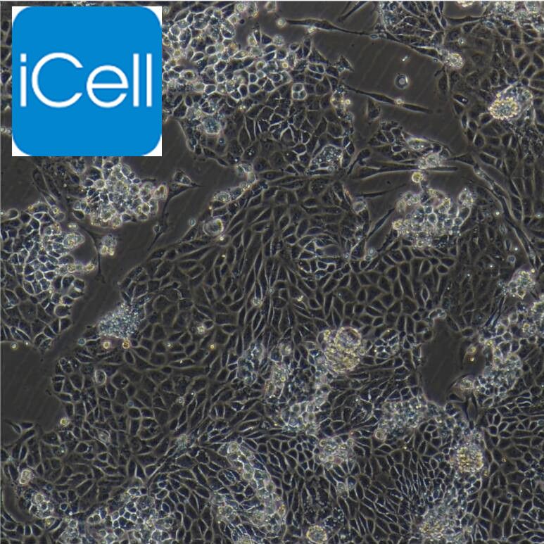 大鼠视网膜微血管内皮细胞/免疫荧光鉴定