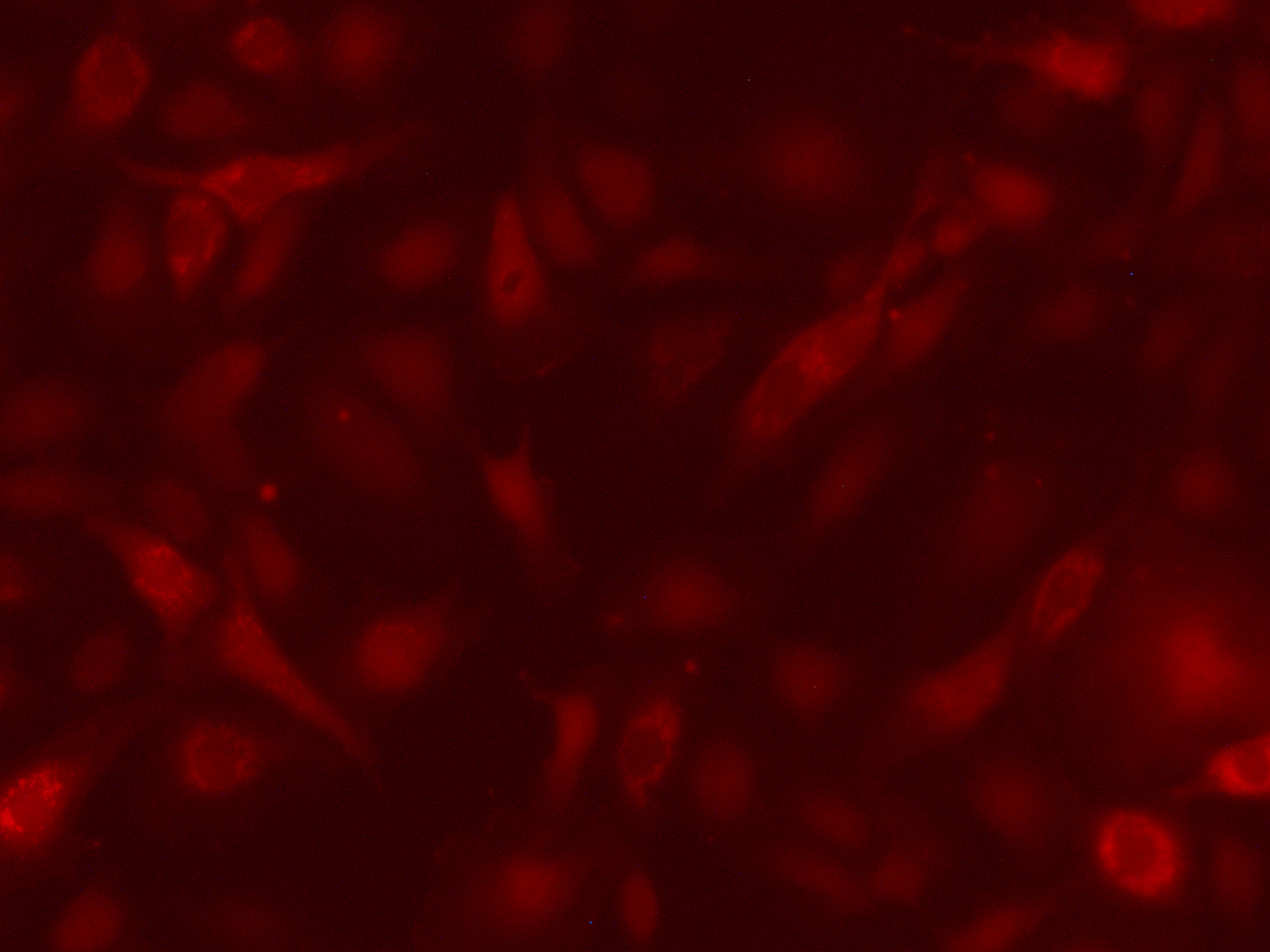 HUVEC-RFP[HUVEC/RFP]红色荧光蛋白标记的人