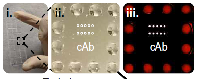 分泌糖蛋白的超灵敏即时免疫分析比PCR检测更早发现埃博拉病毒感染
