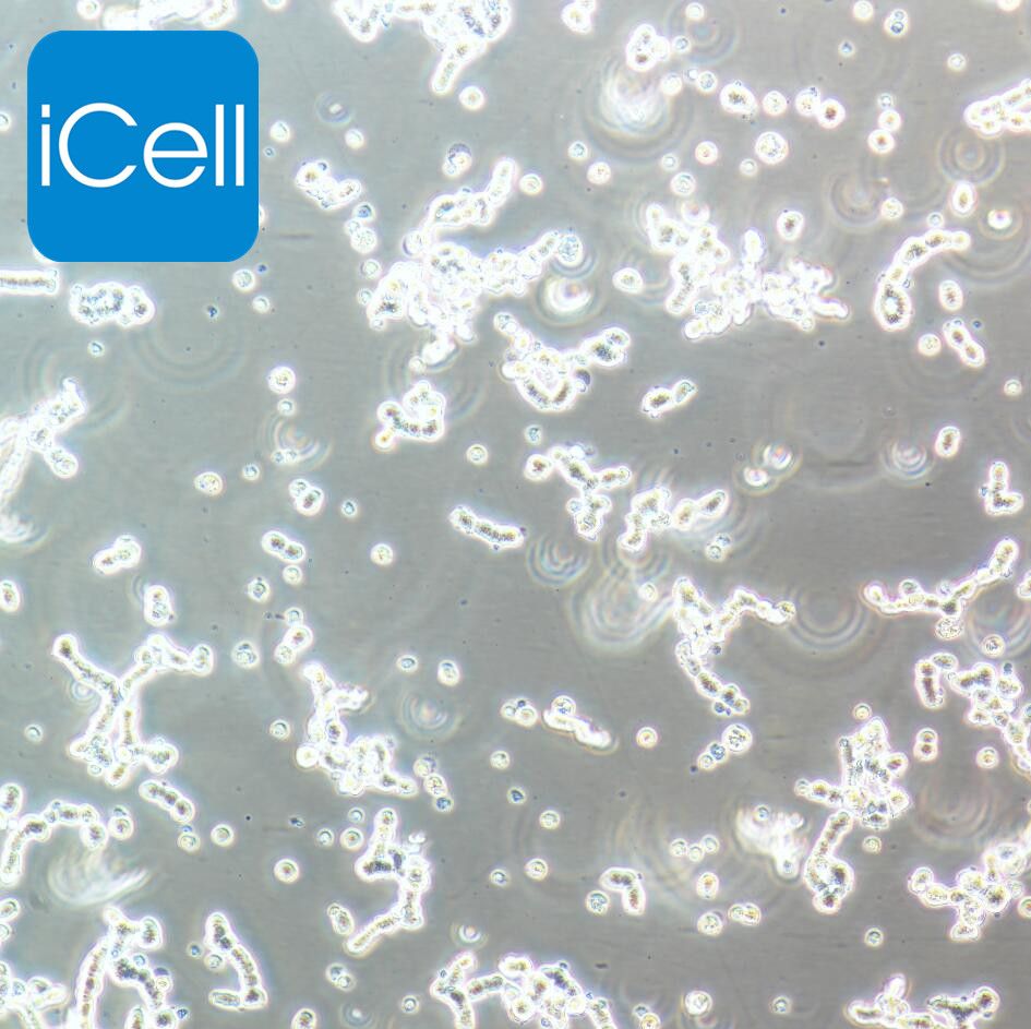 WERI-RB-1 人视网膜神经胶质瘤细胞/STR鉴定/镜像绮点（Cellverse）