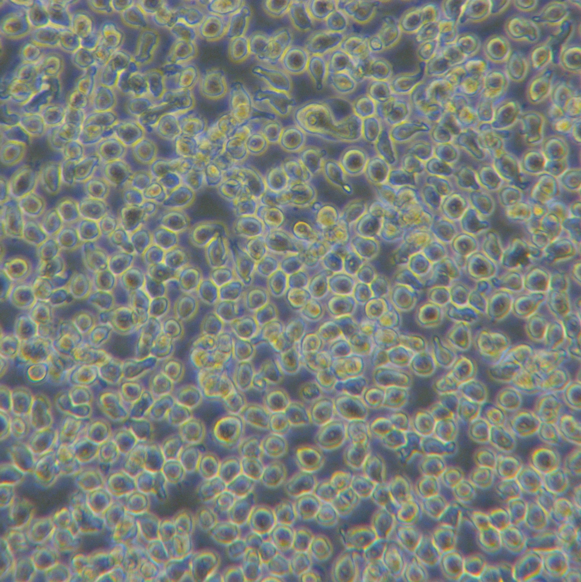 NCI-H929[NCI H929; NCIH929; H929; H-929]骨髓瘤细胞