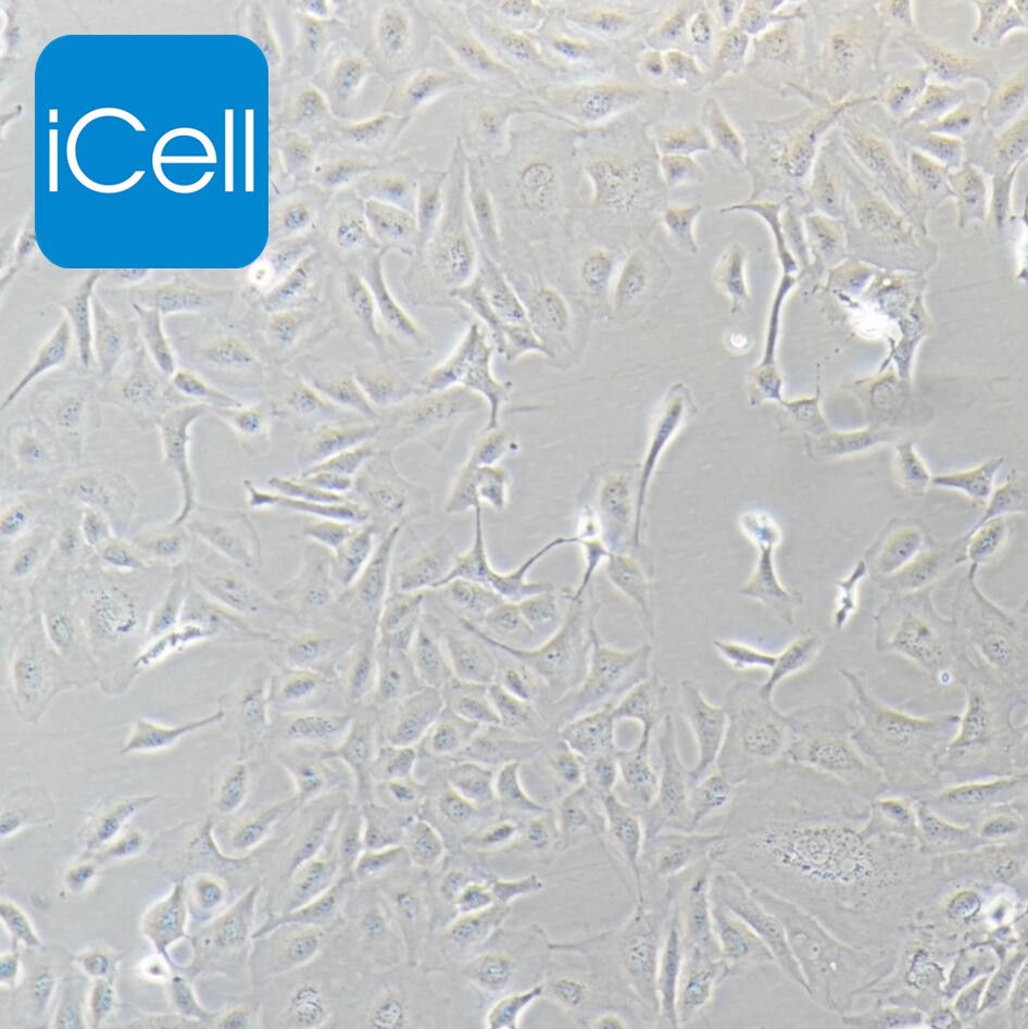 SK-OV-3 人卵巢癌细胞 STR鉴定 镜像绮点（Cellverse）