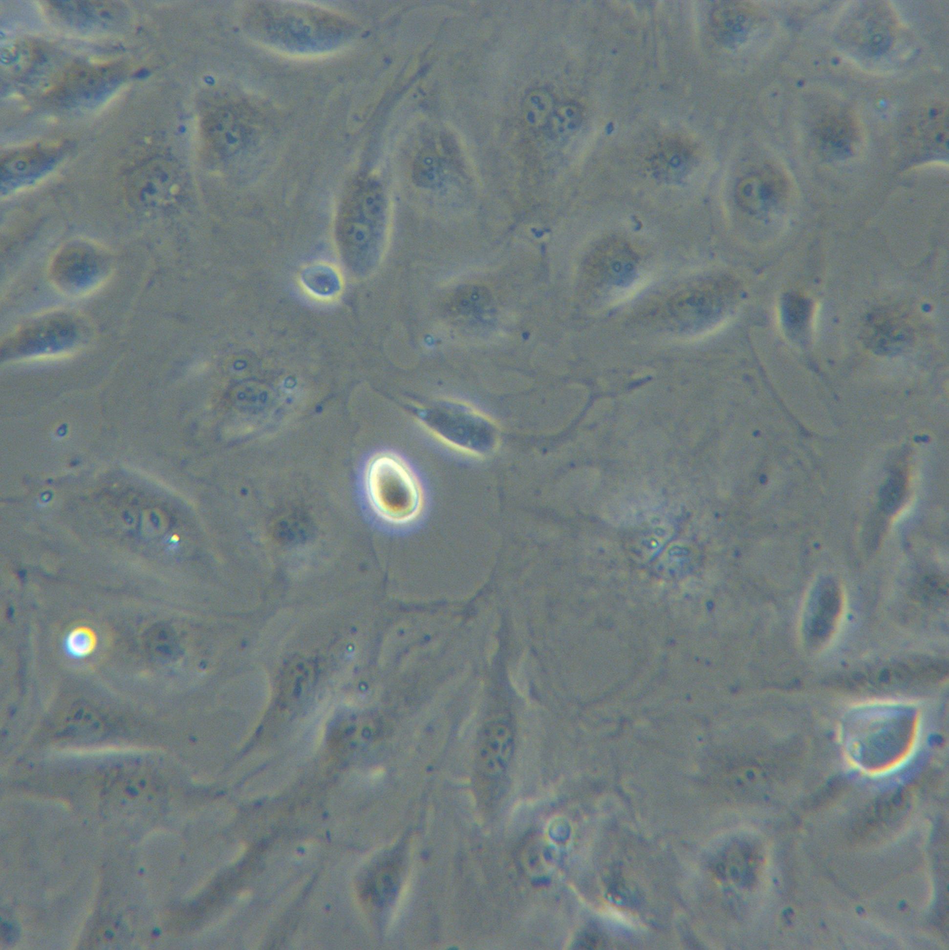 HRMECS永生化视网膜微血管内皮细胞