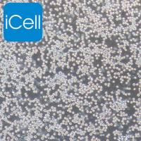 COLO205 人结肠癌细胞/STR鉴定/镜像绮点（Cellverse）