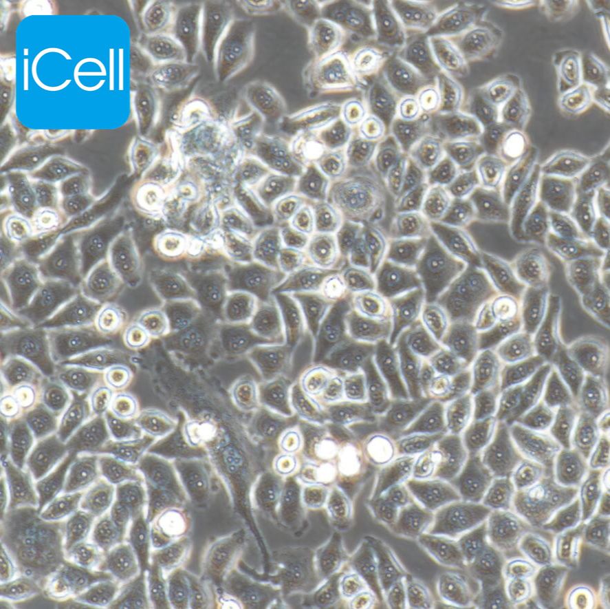 MKN-45 人胃癌细胞/种属鉴定/镜像绮点（Cellverse）