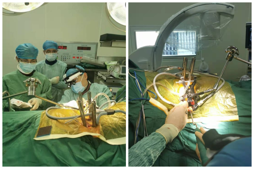 两次手术合二为一！西南医院骨科成功开展国内首例 PTP 技术！