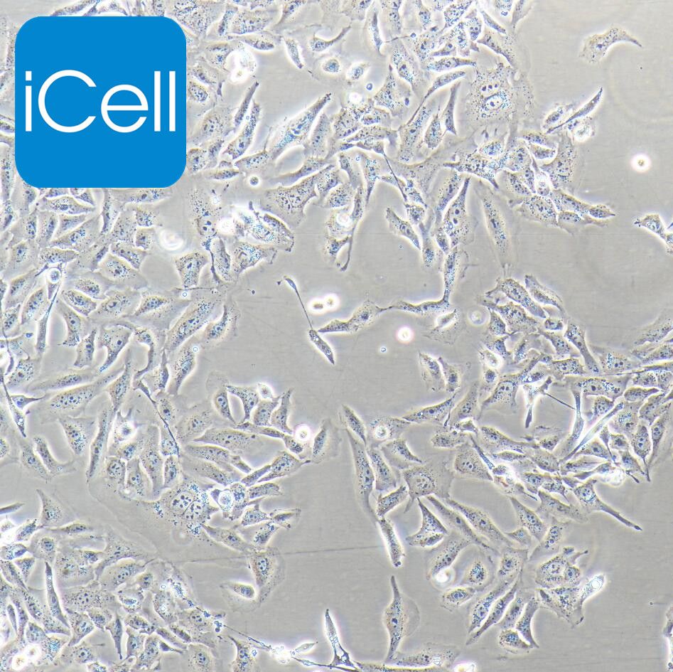 U2OS 人骨肉瘤细胞/STR鉴定/镜像绮点（Cellverse）