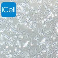 NCI-H1975细胞 | NCI-H1975细胞 | NCI-H1975细胞  |  人肺