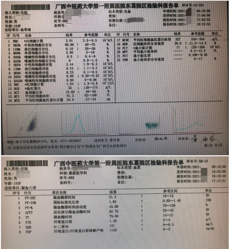 广西中医药大学第一附属医院血液内科联合 ICU 成功救治出血合并血栓的 19 岁急性白血病小伙