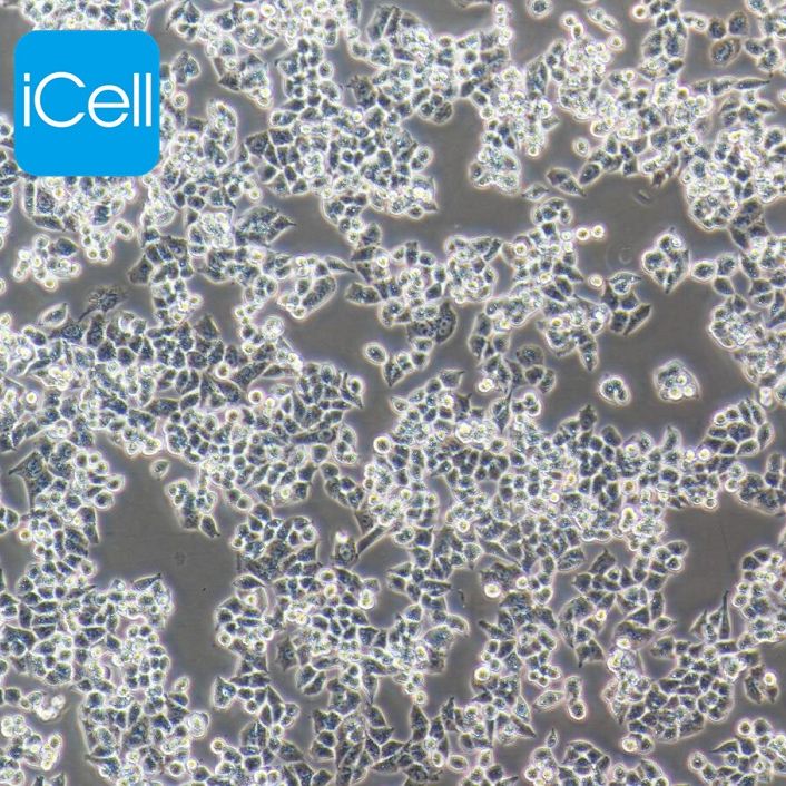 A2780 人卵巢癌细胞/STR鉴定