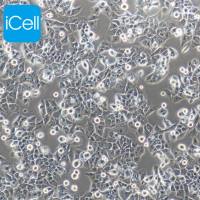 MHCC-97H+luc |MHCC-97H细胞|MHCC97H|MHCC97H细胞|人高转移潜能肝癌细胞（荧光素酶标记 ）