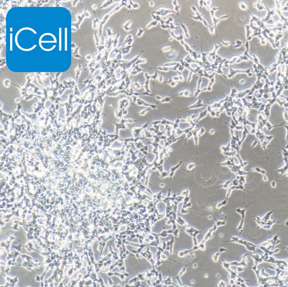SH-SY5Y 人神经母细胞瘤细胞/STR鉴定/镜像绮点（Cellverse）