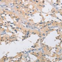 兔抗IKBKG多克隆抗体