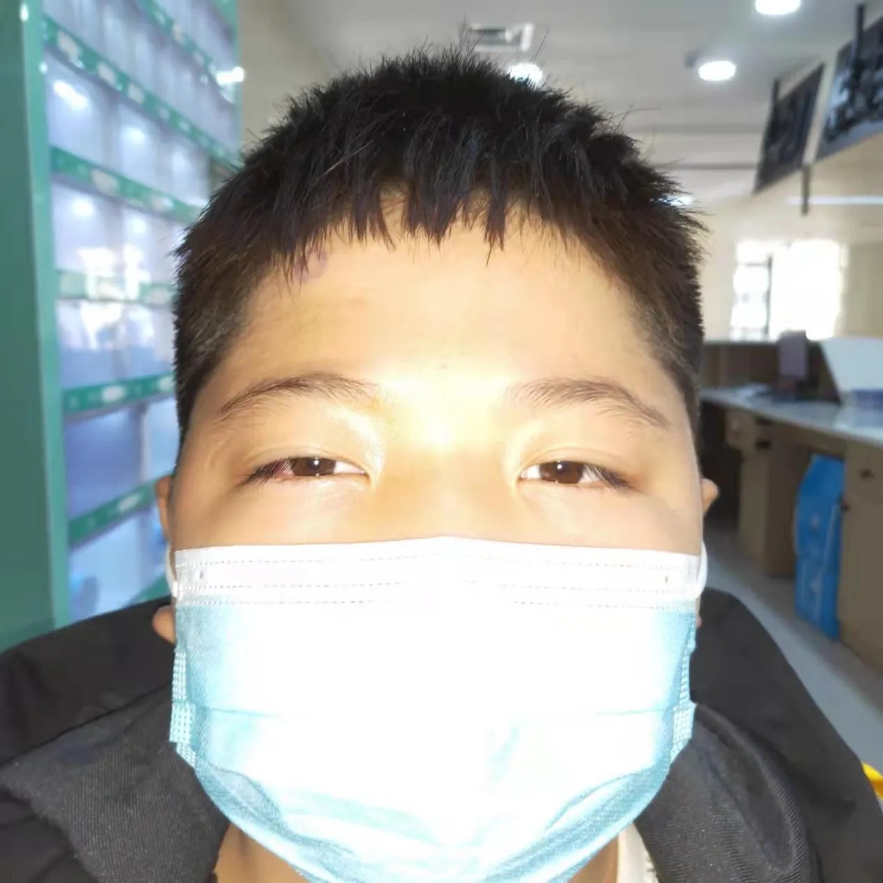 让眼性斜颈患儿回归正常生活:这个症状切勿忽视!