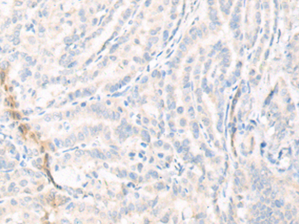 兔抗KCNS3多克隆抗体