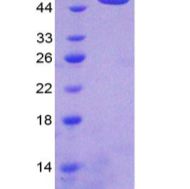 染色质域解旋酶DNA结合蛋白4(CHD4)重组蛋白(多属种)