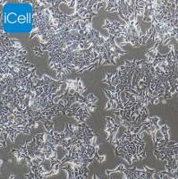 22Rv1 |22Rv1细胞|22-Rv1|22-Rv1细胞|人前列腺癌细胞/STR鉴定/镜像绮点(Cellverse)