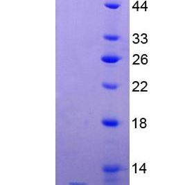 甲基CpG结合蛋白2(MECP2)重组蛋白(多属种)