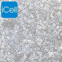 PC-3、PC-3细胞、PC3细胞、PC3 人前列腺癌细胞/STR鉴定