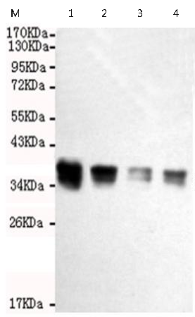 小鼠抗PPP2CAPPP2CB单克隆抗体