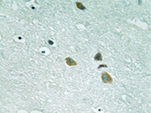 兔抗ILK(Ab246)多克隆抗体
