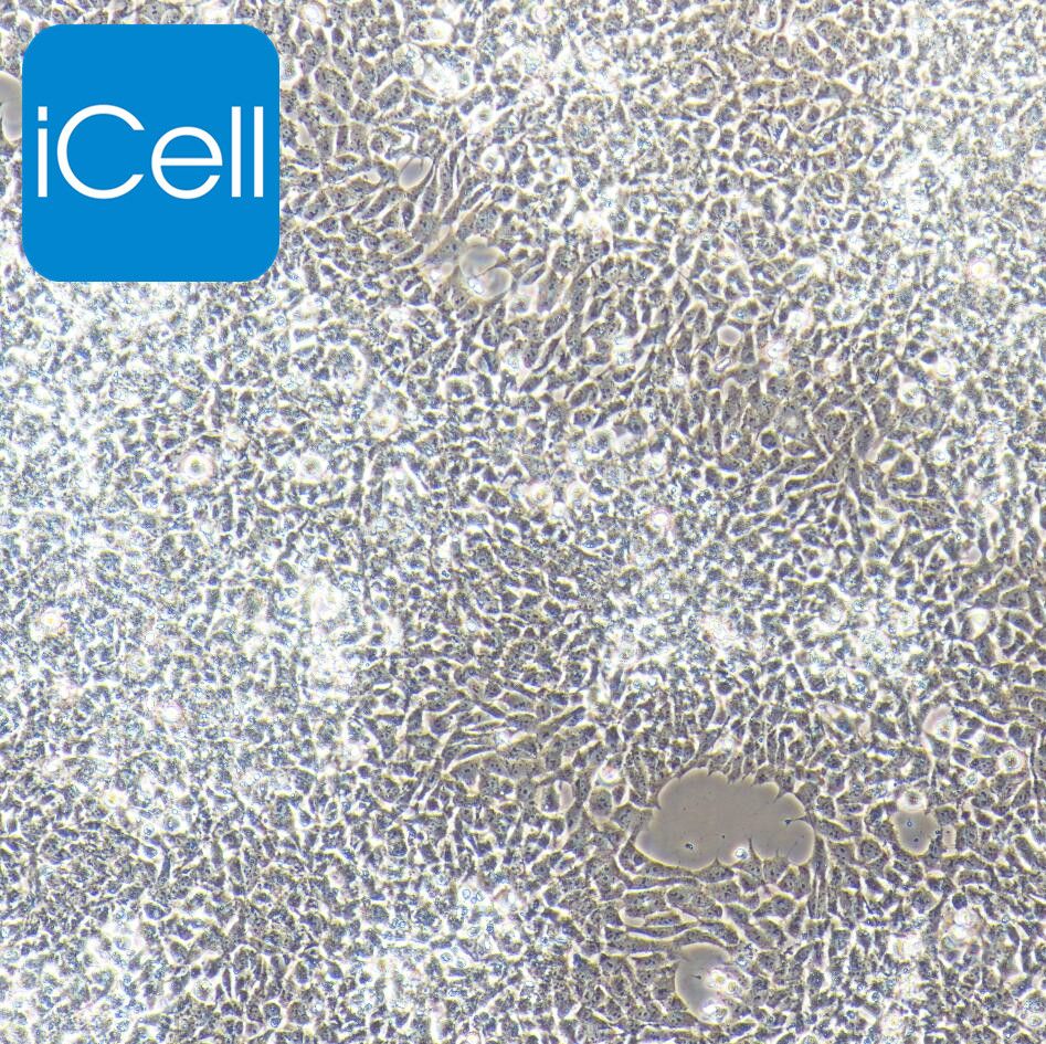 SK-N-MC 人神经上皮瘤细胞/STR鉴定/镜像绮点（Cellverse）