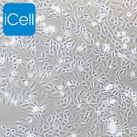 SiHa | SiHa细胞 | 人子宫颈鳞癌细胞/STR鉴定/镜像绮点（Cellverse）