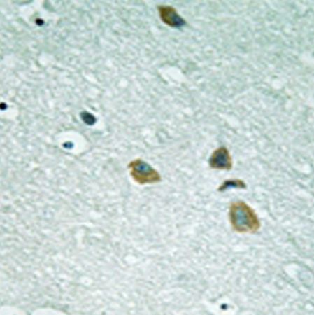 兔抗ILK(Ab-246)多克隆抗体