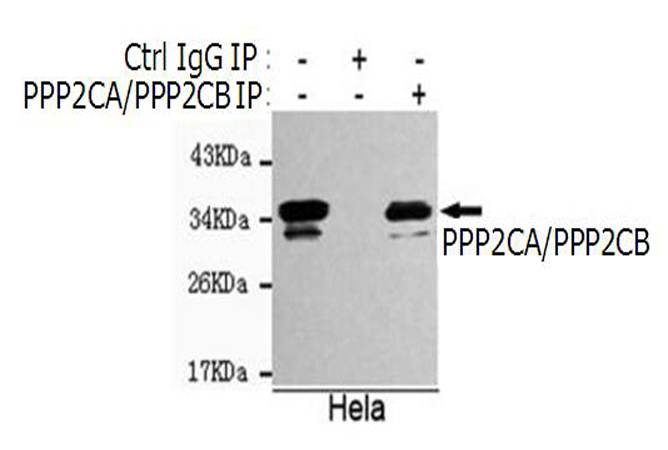 小鼠抗PPP2CAPPP2CB单克隆抗体