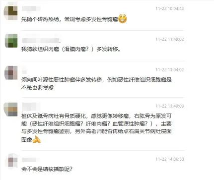 高尚病例：PET/CT 诊断多发性骨髓瘤 1 例