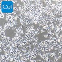 LNCaP clone FGC 人前列腺癌细胞/STR鉴定/镜像绮点（Cellverse）