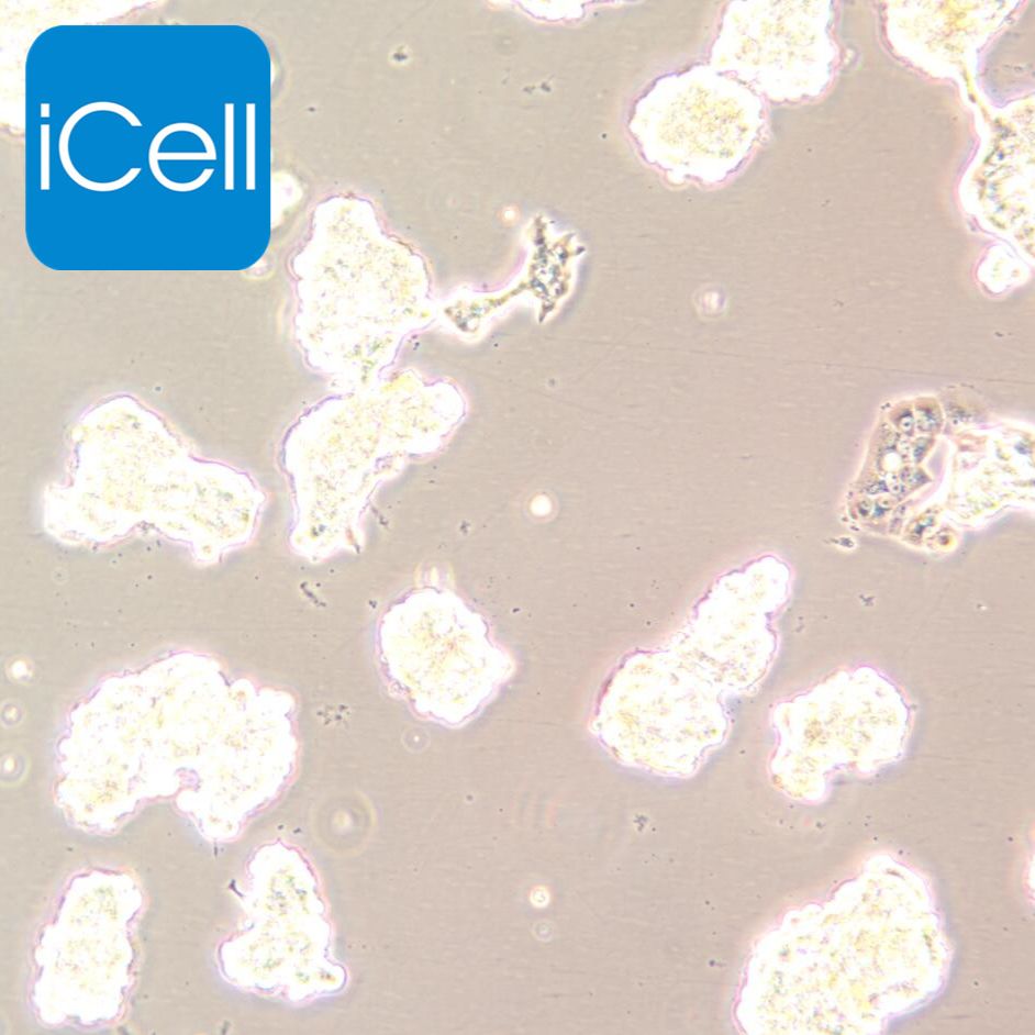 ZR-75-1人乳腺癌细胞/STR鉴定/镜像绮点（Cellverse）