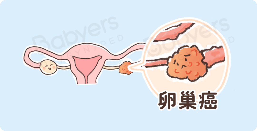 卵巢老 1 岁，女人就老 10 岁 ？8 个小细节需要注意！