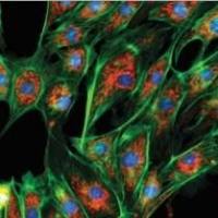 KYSE520细胞系、KYSE-520细胞、KYSE520细胞株