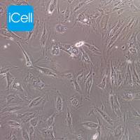 12Z 人子宫内膜异位细胞/STR鉴定/镜像绮点(Cellverse)