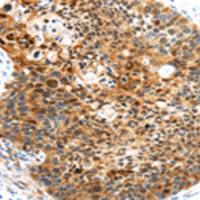 兔抗HUNK多克隆抗体