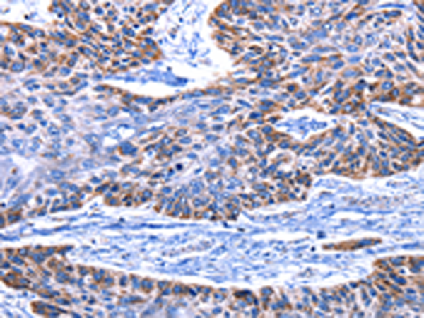 兔抗IGF2BP2多克隆抗体