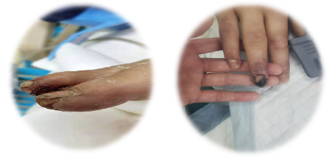 40 余次会诊、18 次大抢救!多学科联合救治,抢回 00 后边防战士生命