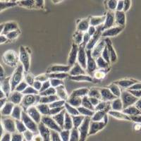 肺腺癌细胞、人肺腺癌细胞、PC-9细胞系