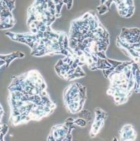 人肝癌细胞;HepG2