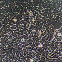 高转移人肝癌细胞;MHCC97-H