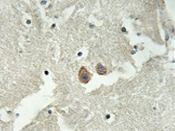 兔抗HMP19多克隆抗体