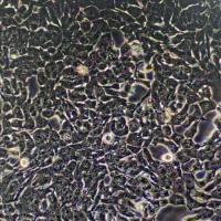 高转移人肝癌细胞;HCCLM3