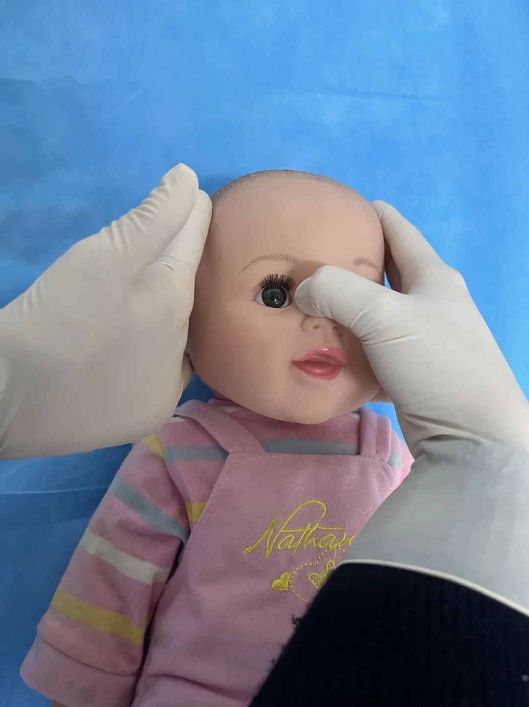 眼角抽出 5 管脓液！宝宝眼睛「水汪汪」居然是病……