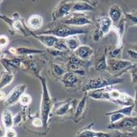 人肺腺癌细胞/NCI-H1975