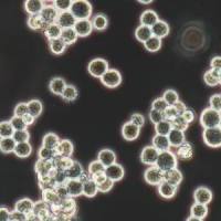 人肺腺癌细胞;NCI-H292