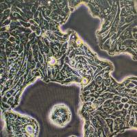 人肺腺癌细胞；Calu-3