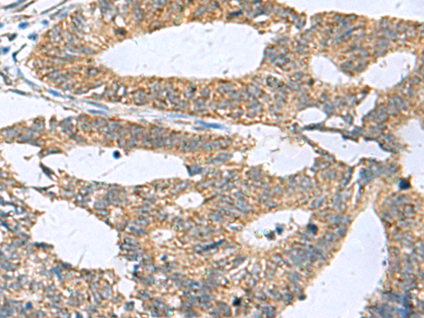 兔抗HPCAL1多克隆抗体
